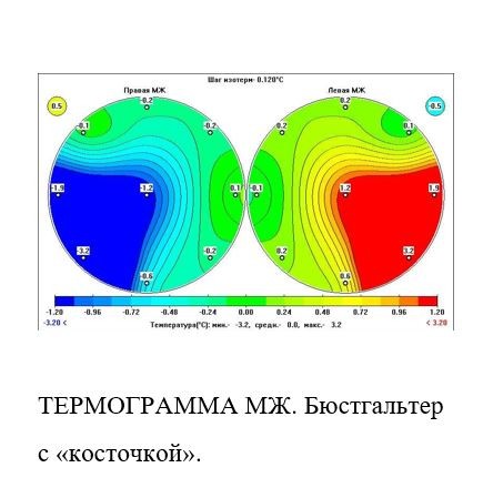 с косточкой.JPG